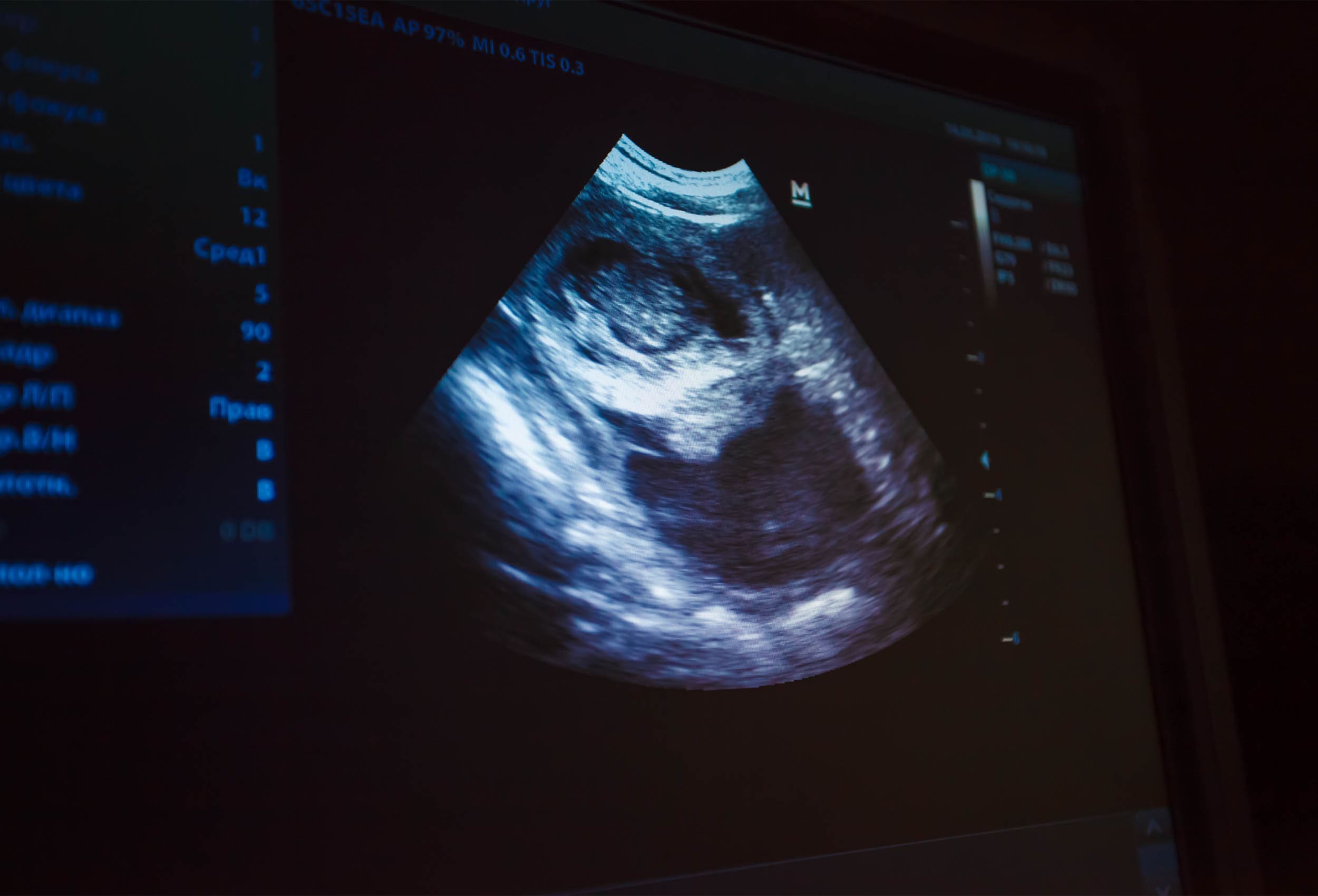 Ultrasounds